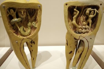 <p>Interesting exhibits showcasing how people in the old days interpreted toothache</p>